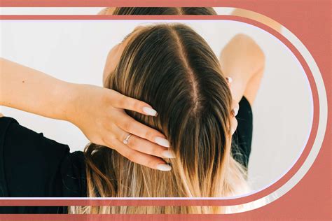 scalp micropigmentation wimbledon|Scalp Micropigmentation 101: Pros, Cons, Cost, and More .